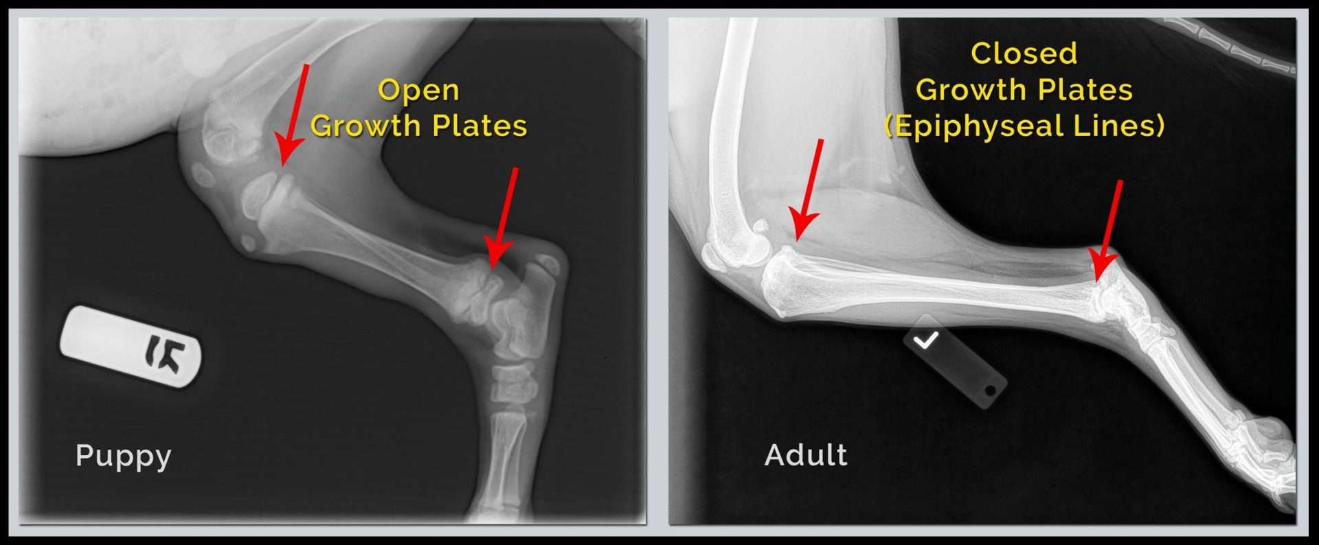 <p>Epiphyseal plates. </p>