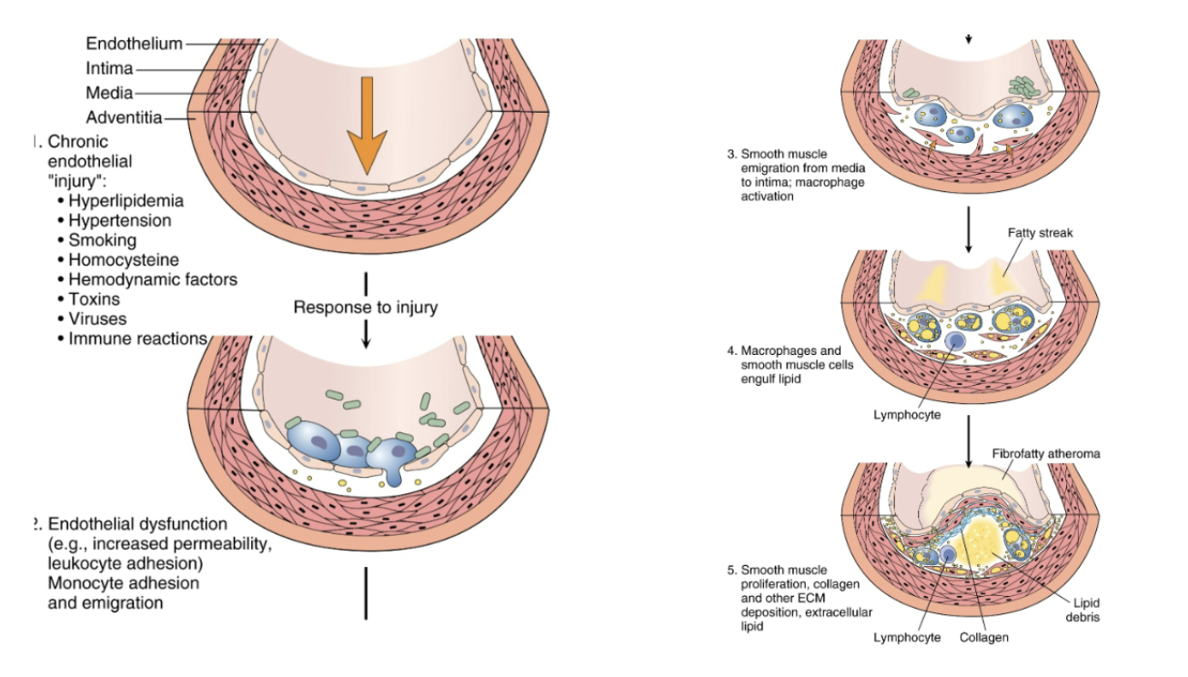 <p>In atherosclerosis, there is endothelial damage. How does this endothelial damage then lead to the development of atherosclerosis?</p>