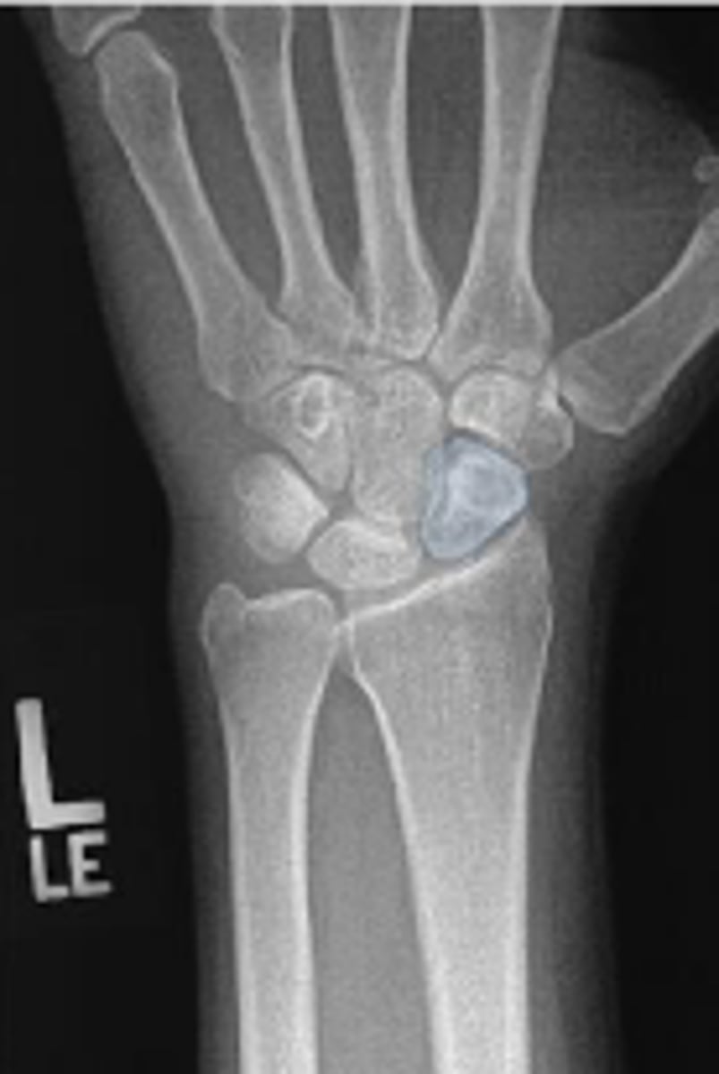 <p>What is outlined?</p>