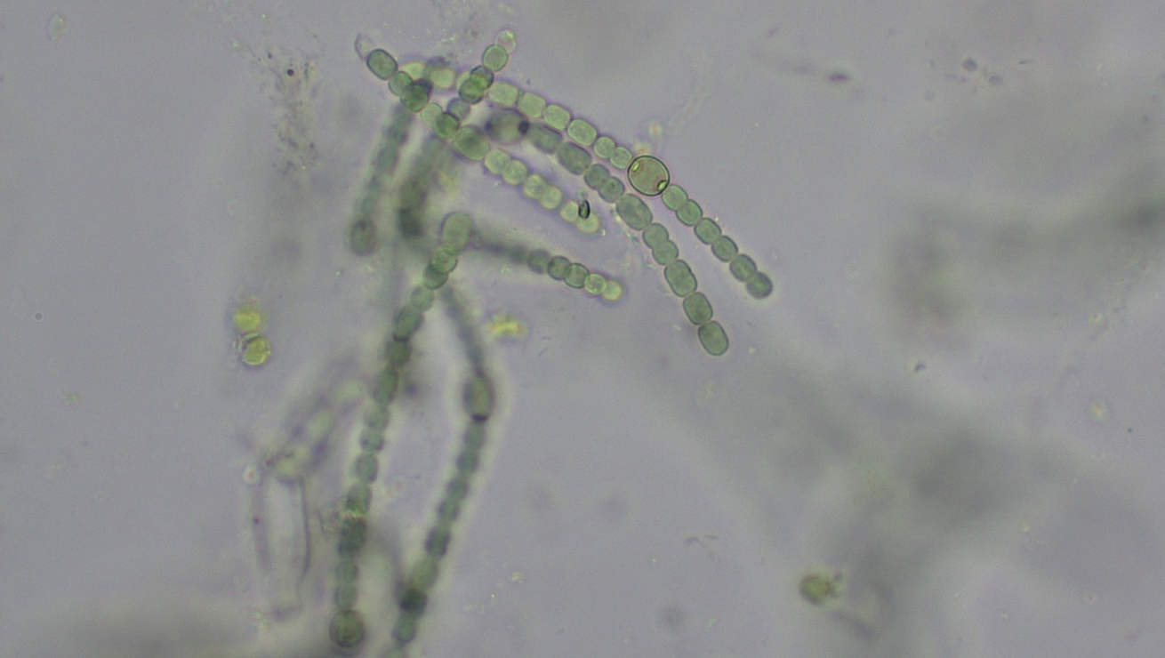 <p>Contains heterocysts</p><p>Domain: Bacteria</p><p>Shape: Coccus but forms filaments</p><p>Movement: non-motile</p><p>Metabolic features: autotrophic</p>