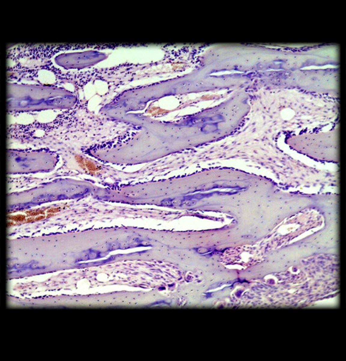 <p>- Thin, branching plates of bone forming a lattice-like structure.</p><p>- Bone marrow is often visible between the trabeculae.</p><p>- Appears as a network of thin, bony plates under the microscope.</p><p>- Found in the ends of long bones and inside flat bones.</p>