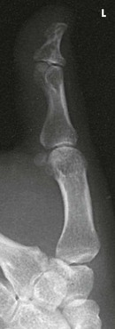 term image