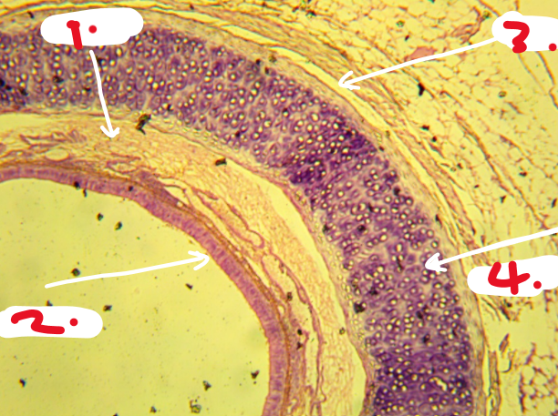 <p>Which one of these arrows is a “cartilaginous matrix with chondrocytes”?</p>