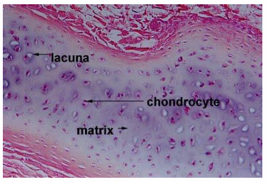 <ul><li><p>chondrocytes in lacunae and extracellular matrix</p></li></ul><p></p>