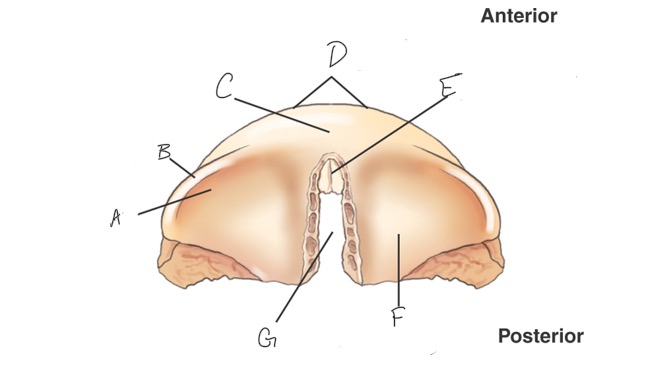 <p>G?</p>