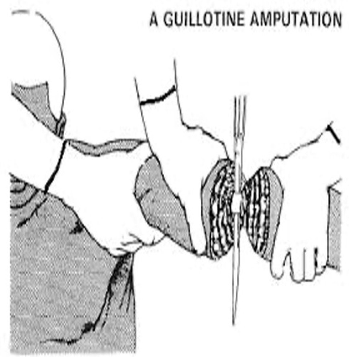 <p>Guillotine (NOT COMMON)</p>