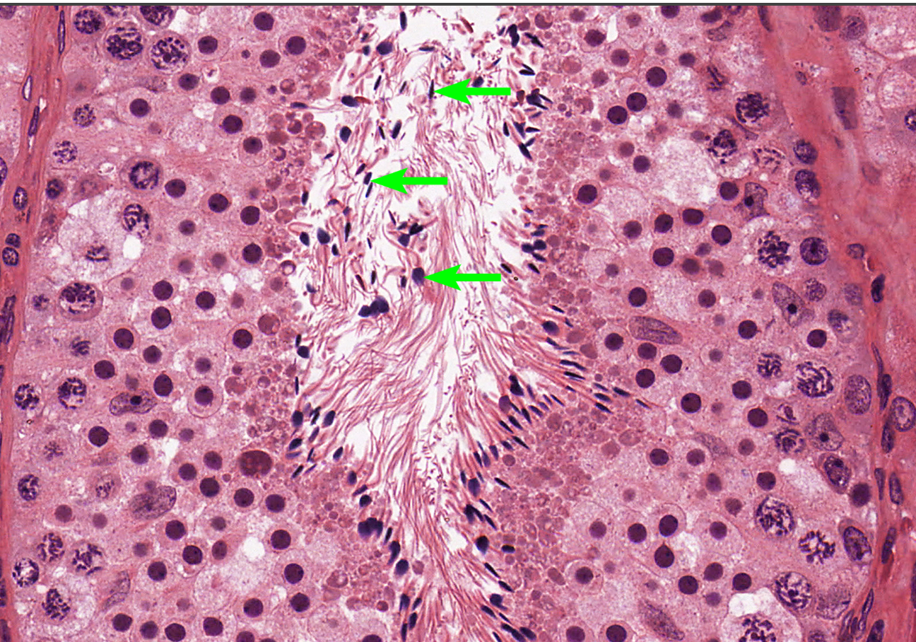 <p>histo; flattened nucelus and cell but within the mess, has tails</p>