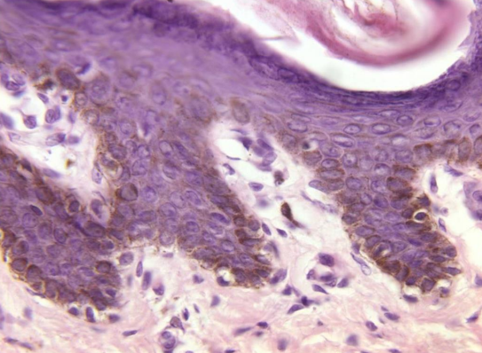 term image