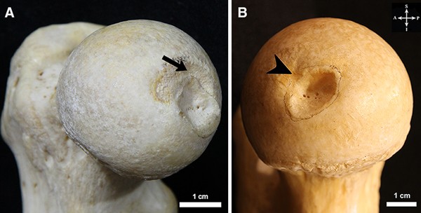 <p>Femur: Bone Location</p>