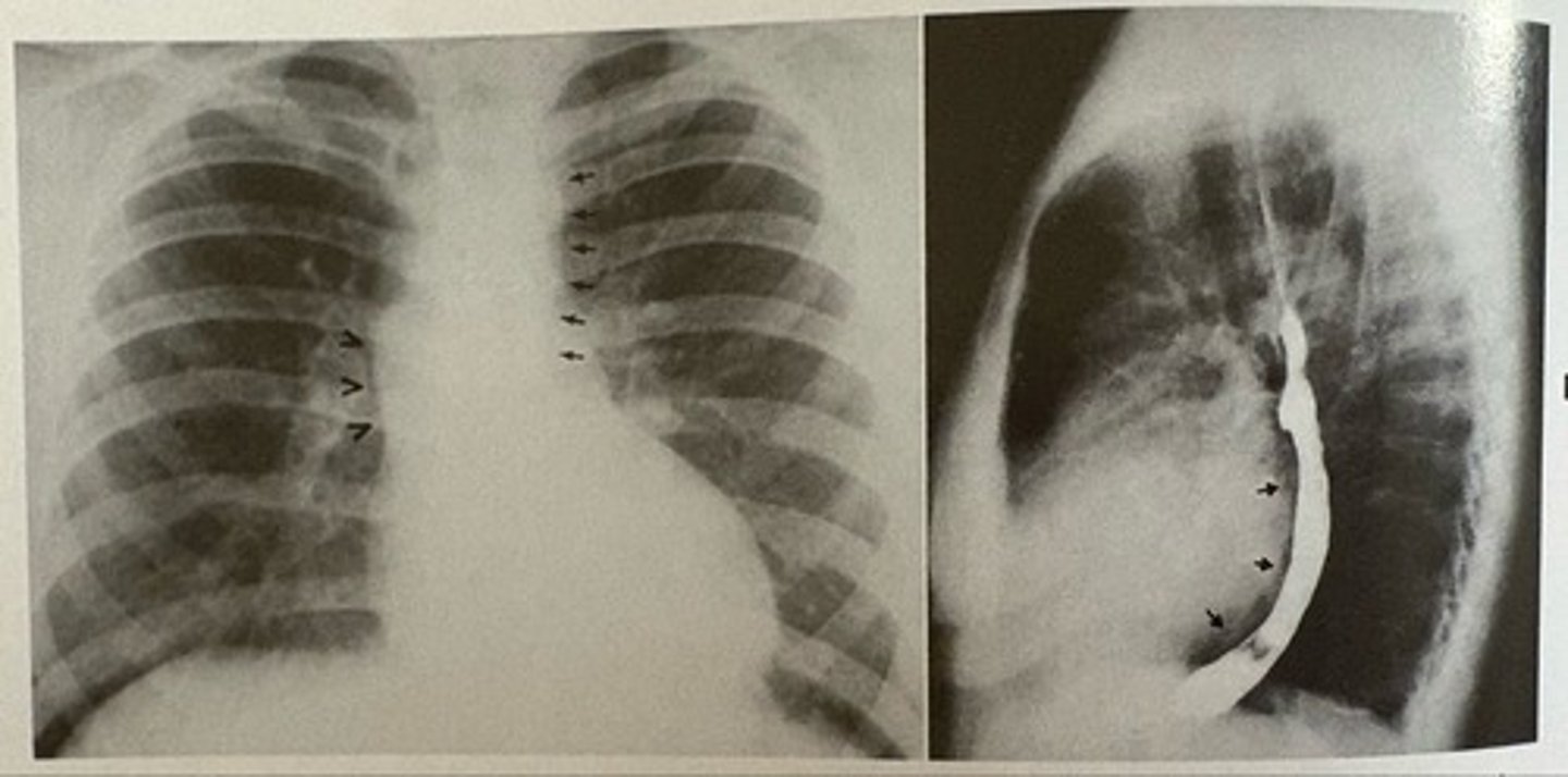 <p>what pathology is present?</p>
