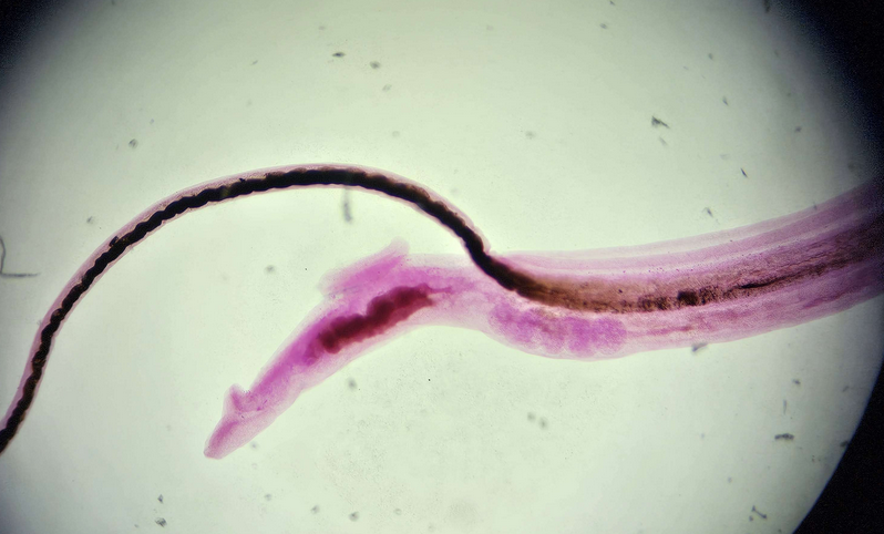 <p><span data-name="microscope" data-type="emoji">🔬</span><span data-name="petri_dish" data-type="emoji">🧫</span><strong><span> </span>Na podstawie zdjęcia preparatu:</strong></p><p></p><ul><li><p><span data-name="book" data-type="emoji">📖</span><span> </span>rozpoznaj gatunek pasożyta;</p></li></ul><p></p><ul><li><p><span data-name="recycle" data-type="emoji">♻</span><span> </span>rozpoznaj wszystkie formy rozwojowe;</p></li></ul><p></p><ul><li><p><span data-name="microbe" data-type="emoji">🦠</span><span> </span>wskaż organelle i cechy charakterystyczne dla danego gatunku;</p></li></ul><p></p><ul><li><p><span data-name="mask" data-type="emoji">😷</span><span> </span>nazwij chorobę, którą pasożyt wywołuje.</p></li></ul><p></p>