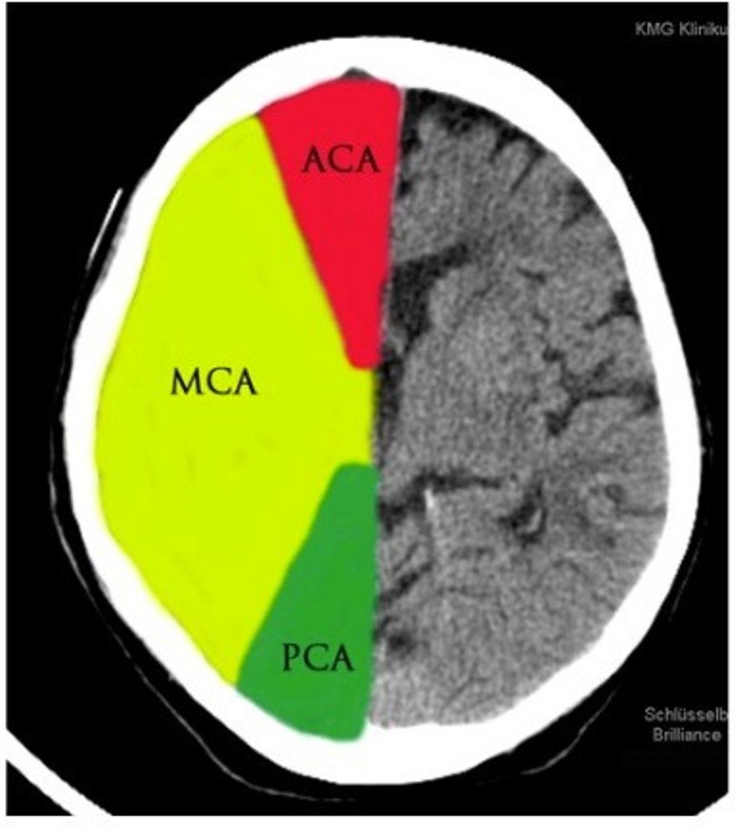 <p>medial surface, blood to foot and leg area of motor strip</p>