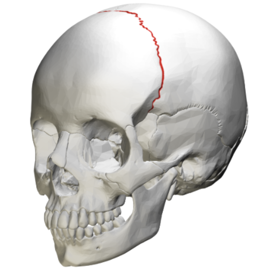 <p>what is this skull feature? </p>