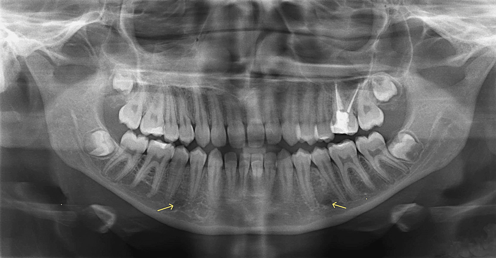 <p>what is this, its description and its appearance on images</p>