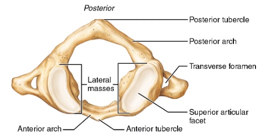 <p>Articulates with occipital condyle, allows nodding, C1</p>