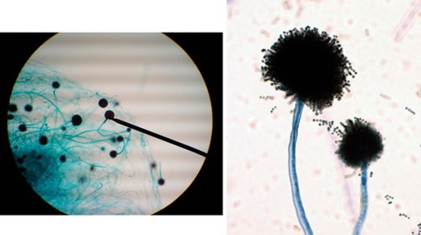 <p>fungi</p><p>sporangium</p><p>spores</p><p>hyphae</p>