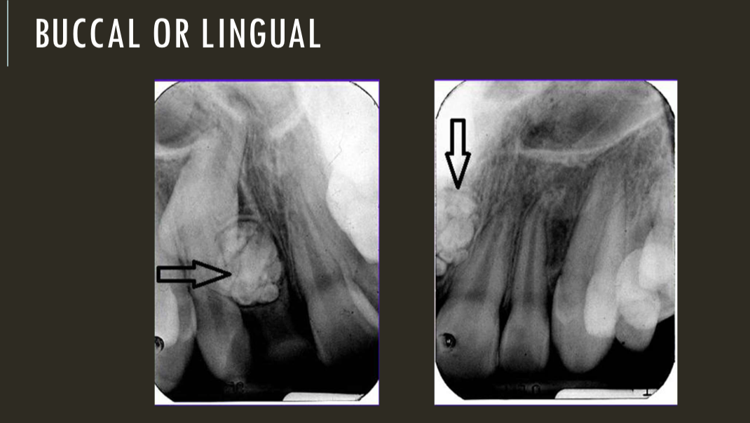 term image