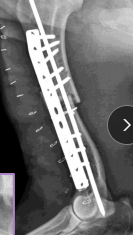 <p><span style="background-color: transparent;"><strong>Humeral Fractures</strong></span></p>