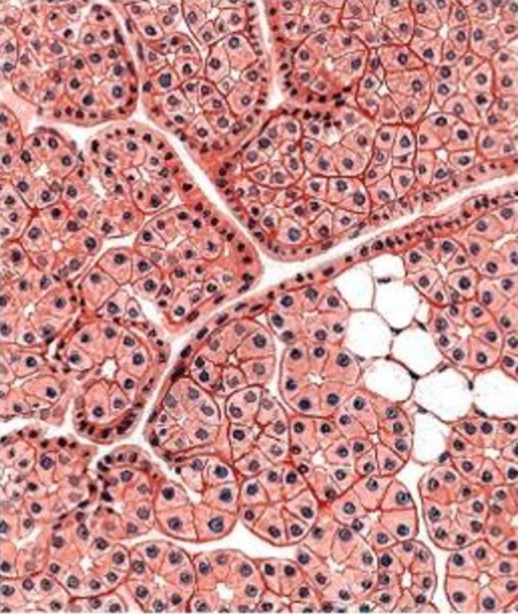 <p>- parotid</p><p>- we see acinar cells with perfectly round nuclei</p><p>- serous secretions only, mucus is rare</p><p>- the unstained cells are adipose cells</p>