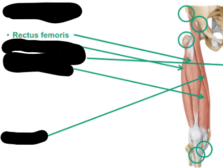 <p>Describe the Rectus Femoris thigh muscle </p>