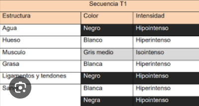<p>INTENSIDAD</p>