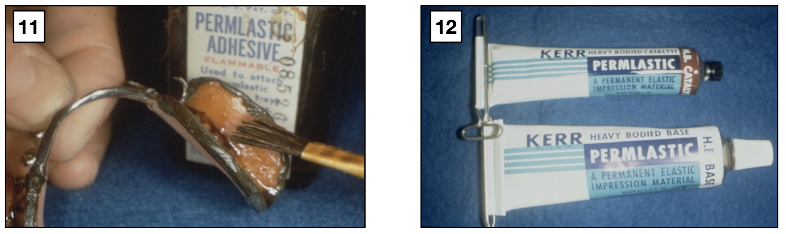 <p>which steps of altered cast technique impression?</p>
