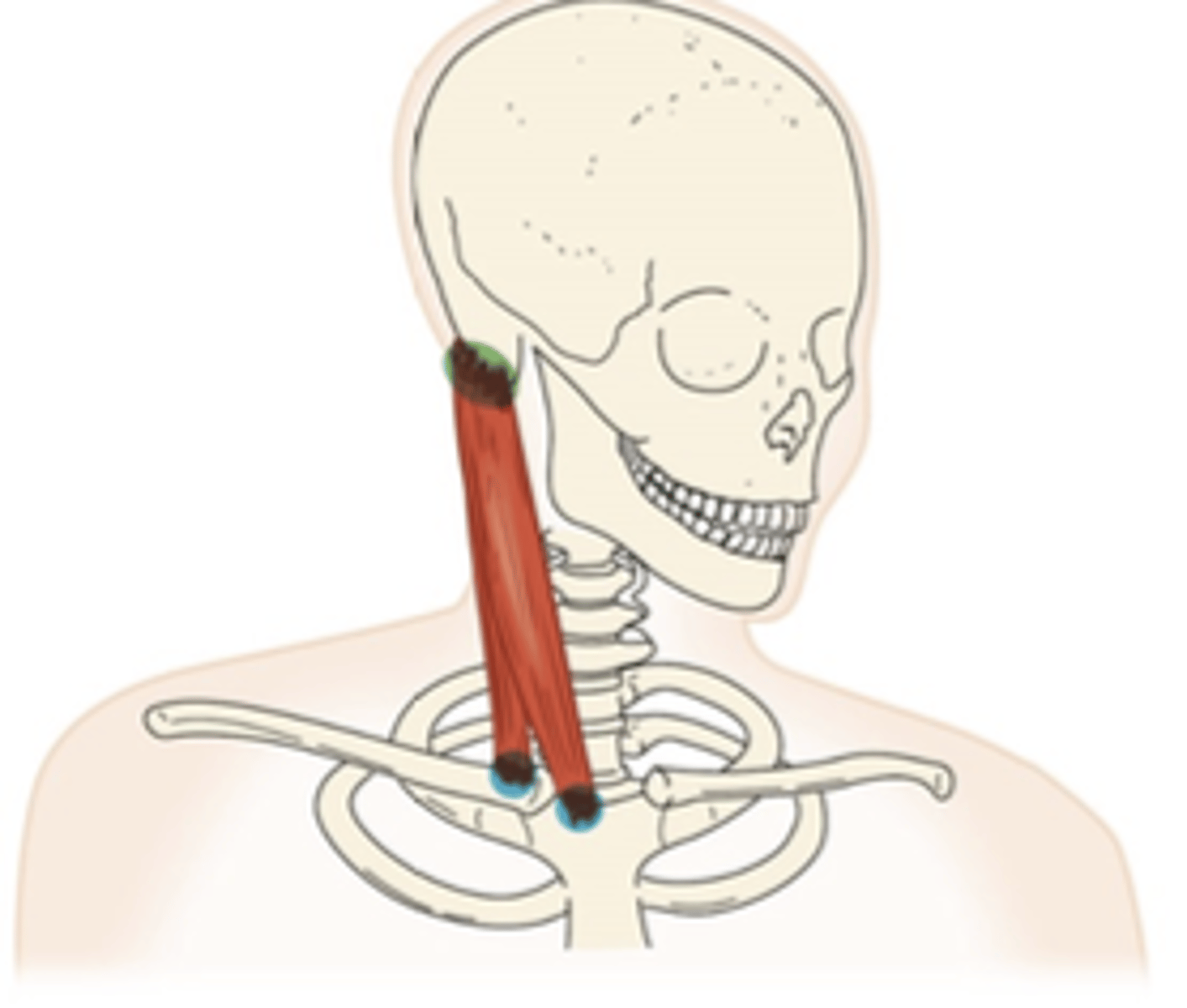 <p>What muscle is this?</p>