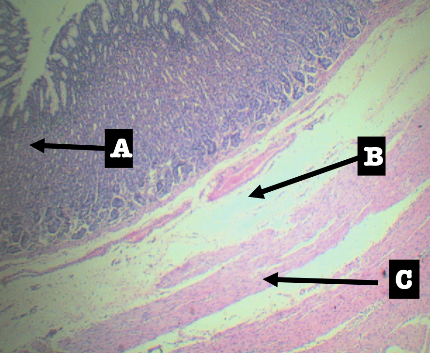 <p>Mucosa (A)</p>