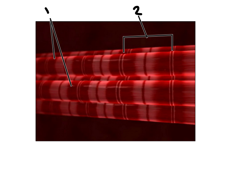 <p>Label the image</p>