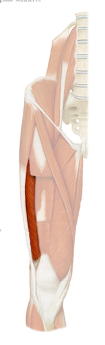 <p>-lower extremity (pelvis, anterior and medial thigh)</p>