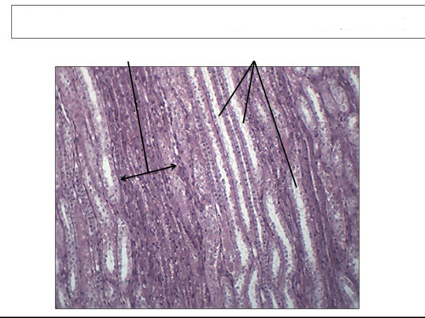<p>identify this organ/structure</p>