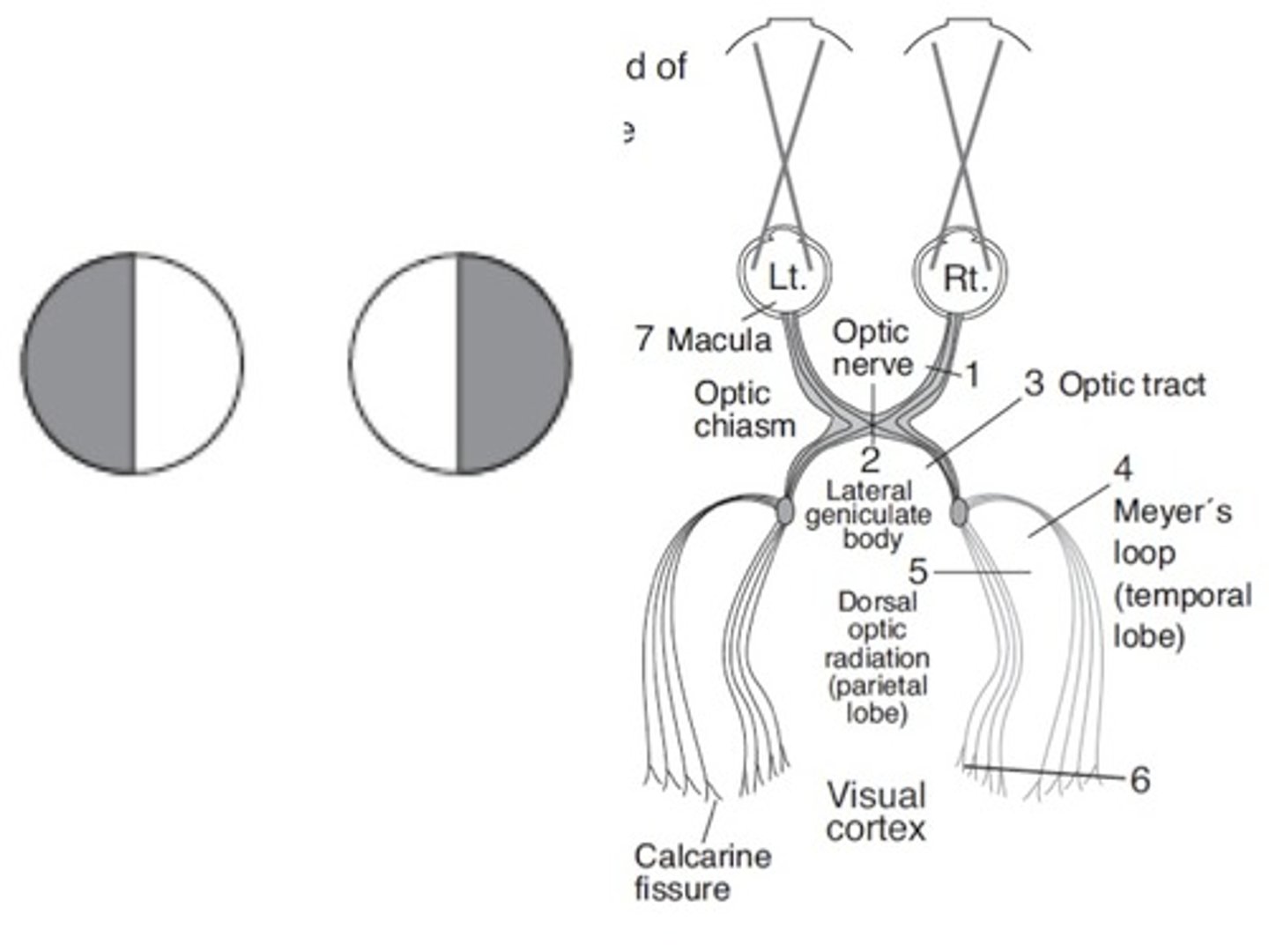 <p>- Headache</p><p>- Vision loss (bitemporal hemianopia d/t compression)</p><p>- Diplopia</p><p>- Ptosis</p><p>- Ophthalmoplegia</p><p>- Decreased facial sensation (d/t CN compression)</p>