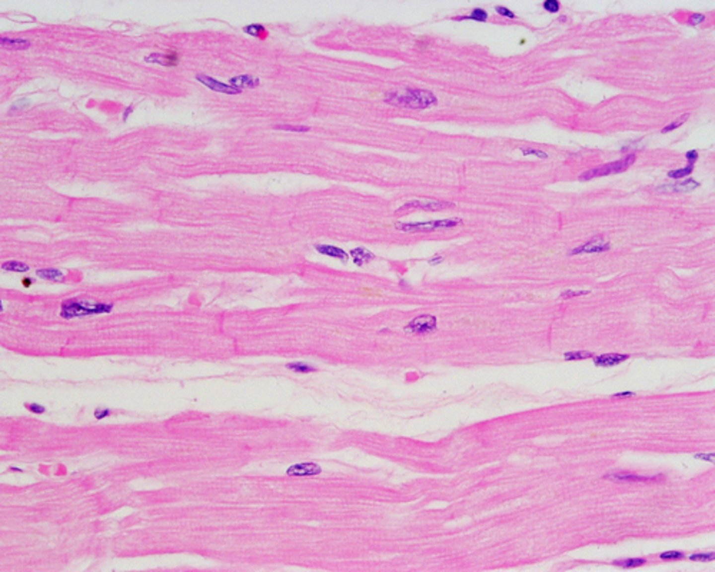 <p>Involuntary muscle forming most of the heart walls, with branched fibers, striations, and intercalated discs.</p>