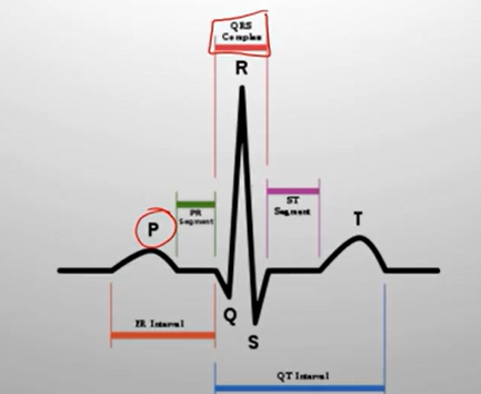 <ul><li><p><strong>P wave</strong> → <strong>Atrial depolarization</strong> (atria activated → contract).</p></li><li><p><strong>PR interval</strong> → Signal travels through AV node → to ventricles.</p></li><li><p><strong>QRS complex</strong> → <strong>Ventricular depolarization</strong> (ventricles activated → contract).</p><ul><li><p><em>Atrial repolarization happens here too, but it’s hidden inside the QRS.</em></p></li></ul></li><li><p><strong>ST segment</strong> → Early part of <strong>ventricular repolarization</strong> (should be flat).</p></li><li><p><strong>T wave</strong> → <strong>Ventricular repolarization</strong> (ventricles reset/relax).</p></li><li><p><strong>U wave (sometimes seen)</strong> → Final phase of <strong>ventricular repolarization</strong> (extra reset, not always visible).</p></li></ul><p></p>