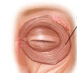 <p>Skeletal Muscle Location:</p>