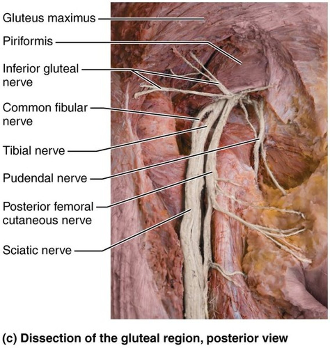 <p>The thickest and longest nerve, supplies the entire lower limb except for the anteromedial upper leg, and divides into tibial and common fibular nerves.</p>