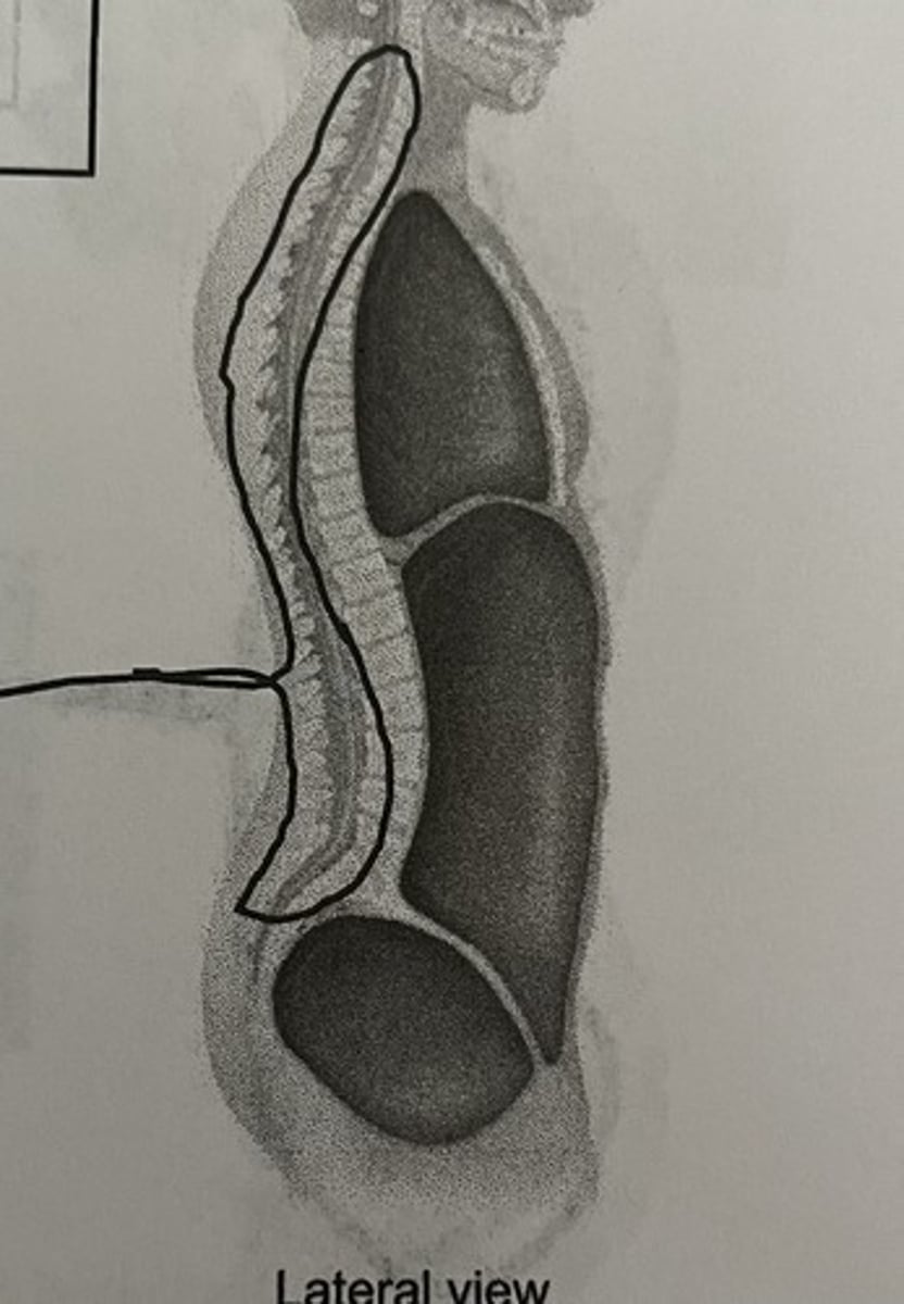 <p>What cavity does this picture represent?</p>