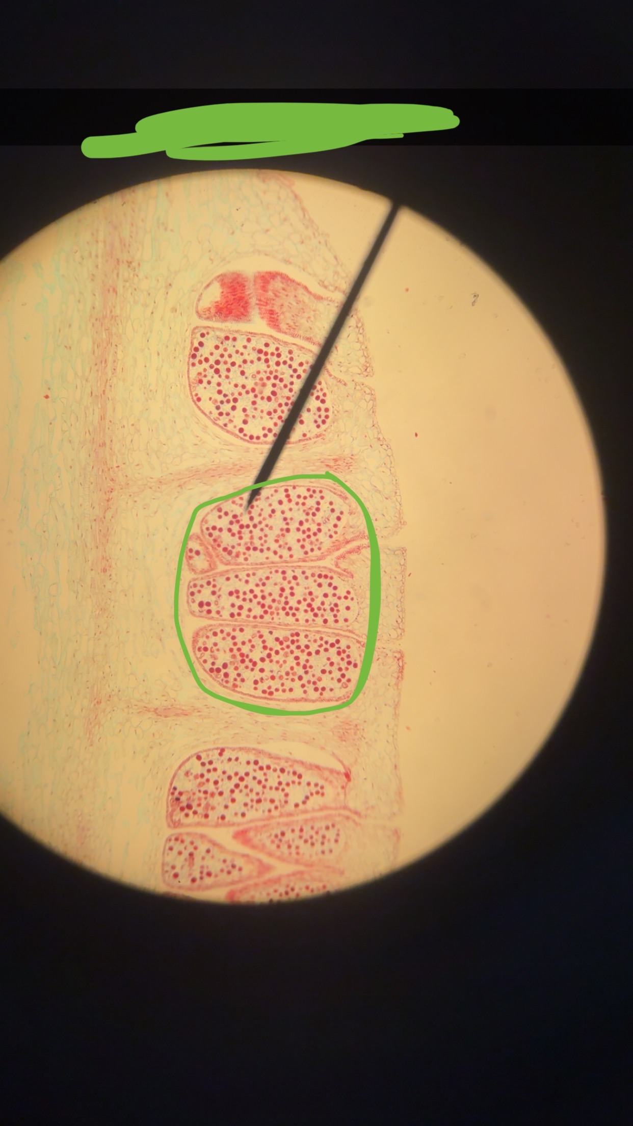 <p>What is the green circle </p>