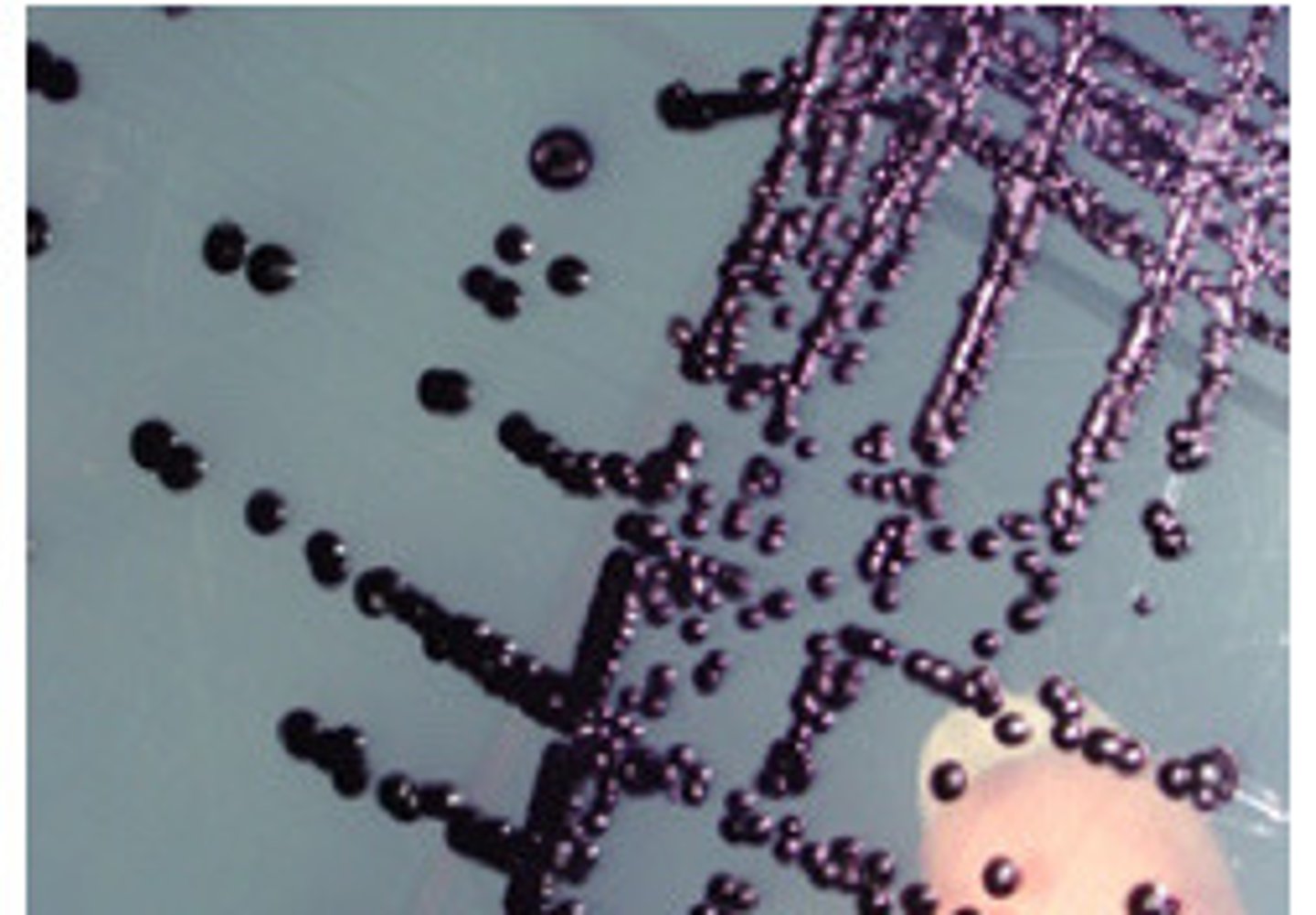 <p>GNB, cat pos, violet colonies, indole neg, nitrate pos, DNAse pos</p>