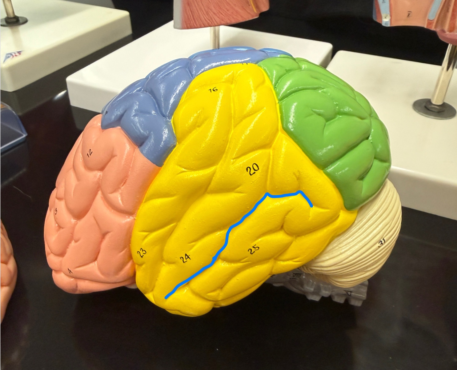 <p>What is outlined in blue on the brain model?</p>