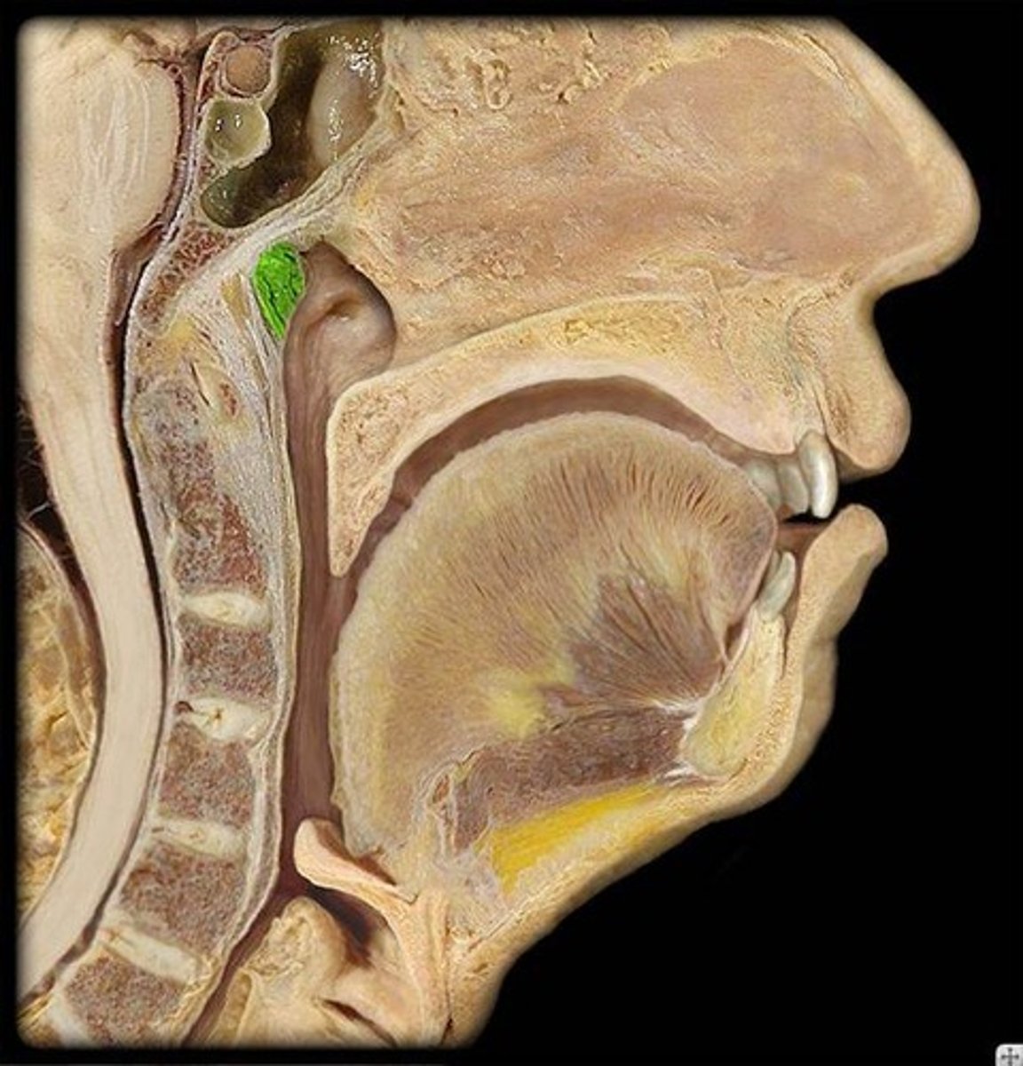 <p>Name this highlighted structure.</p>