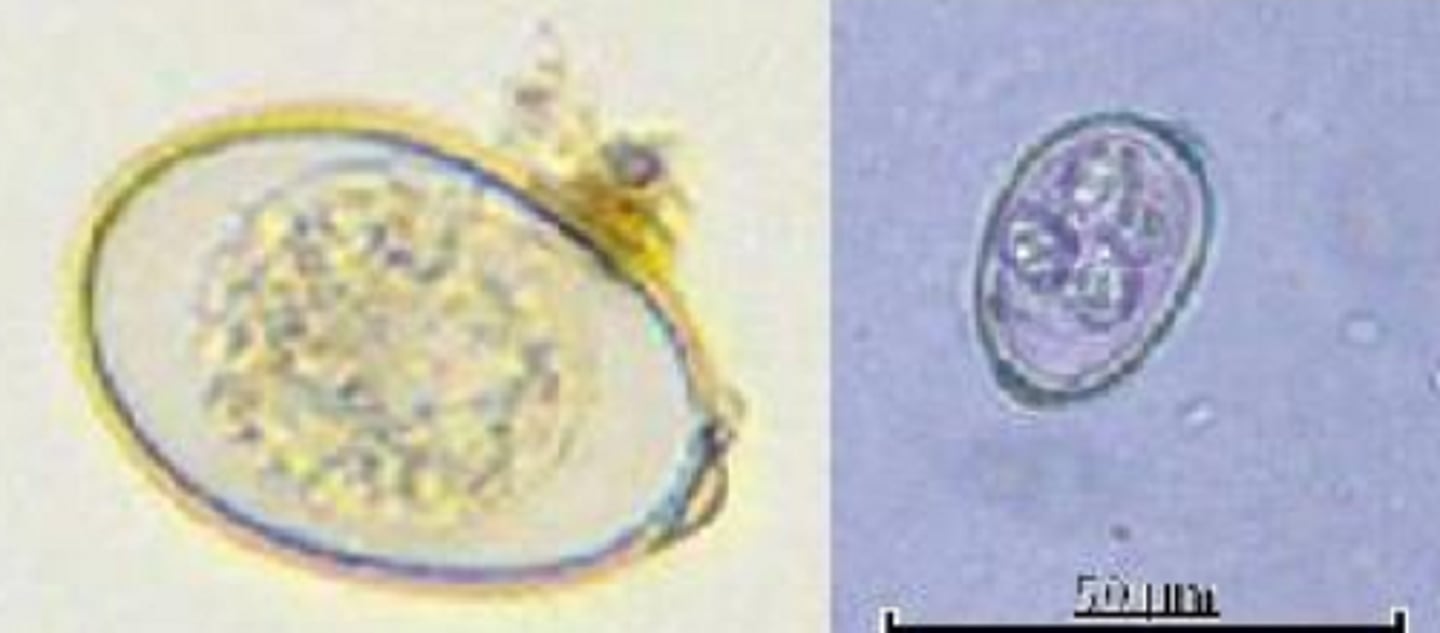 <p>Hard boiled egg with cap at one end</p><p>Cattle, Sheep, Goats</p><p>Small and Large Intestine</p>