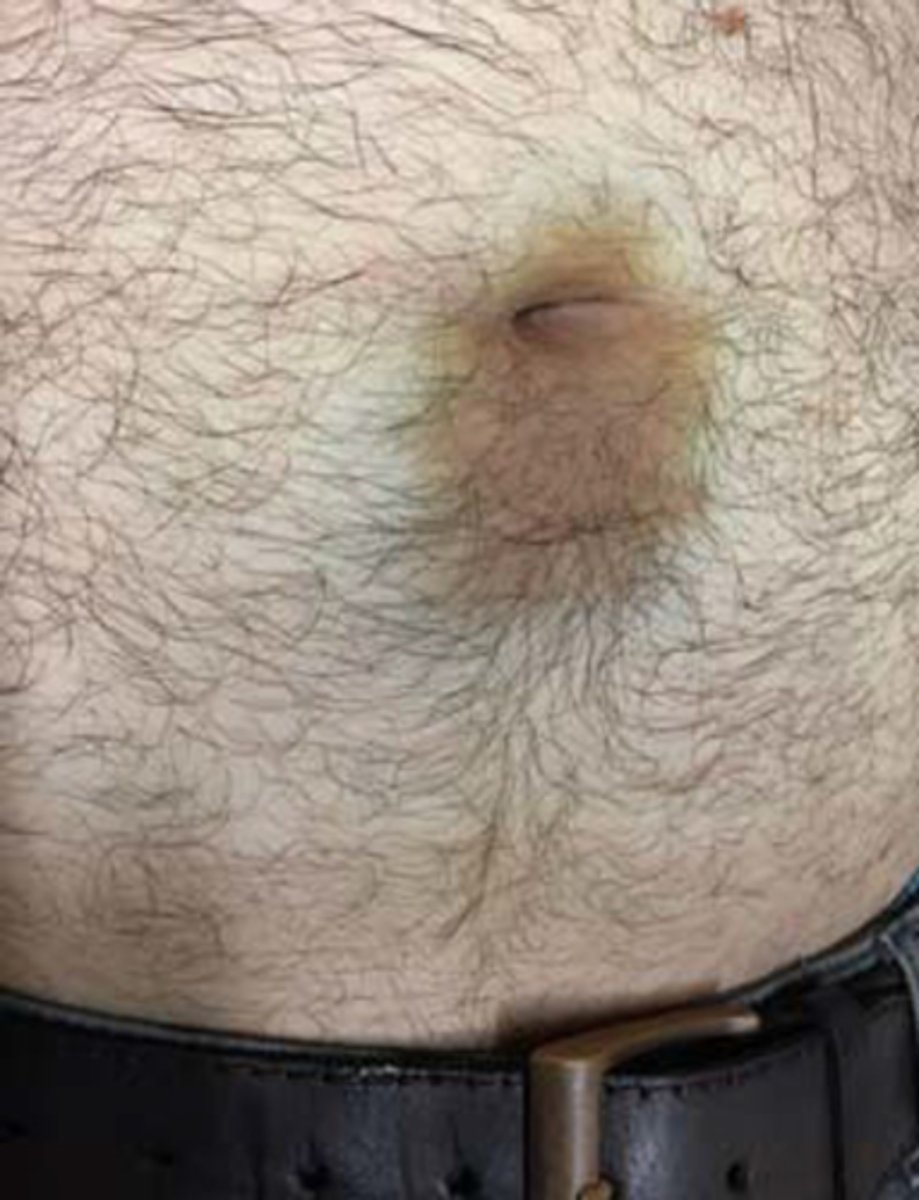 Clinical Diagnosis Quiz 5 Abdomen, MSK, Imaging tests Flashcards Knowt