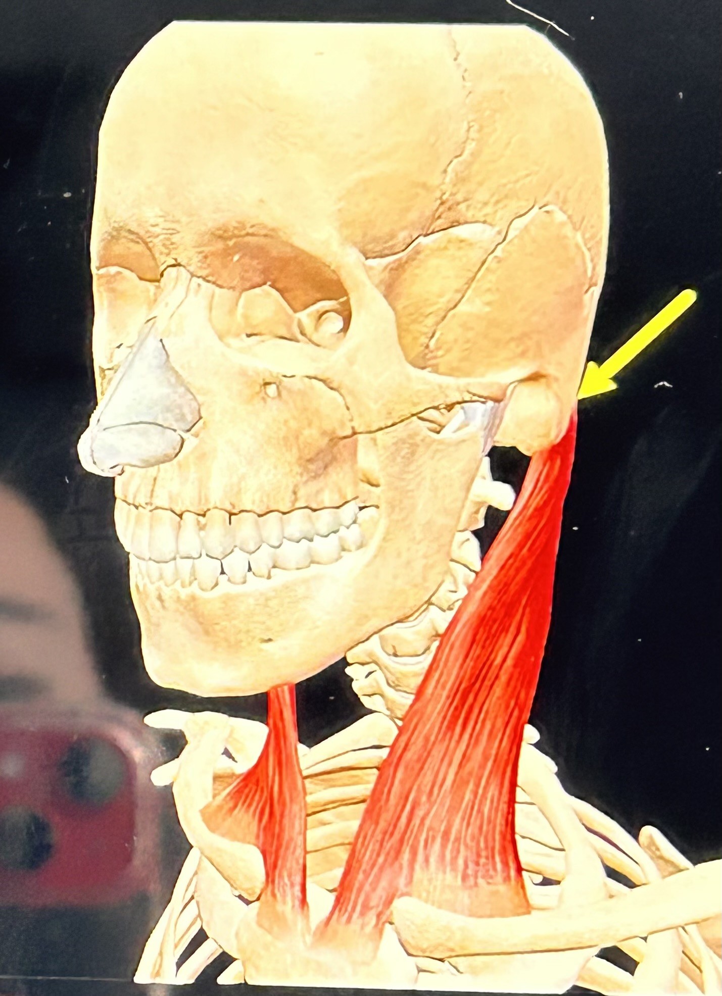 term image