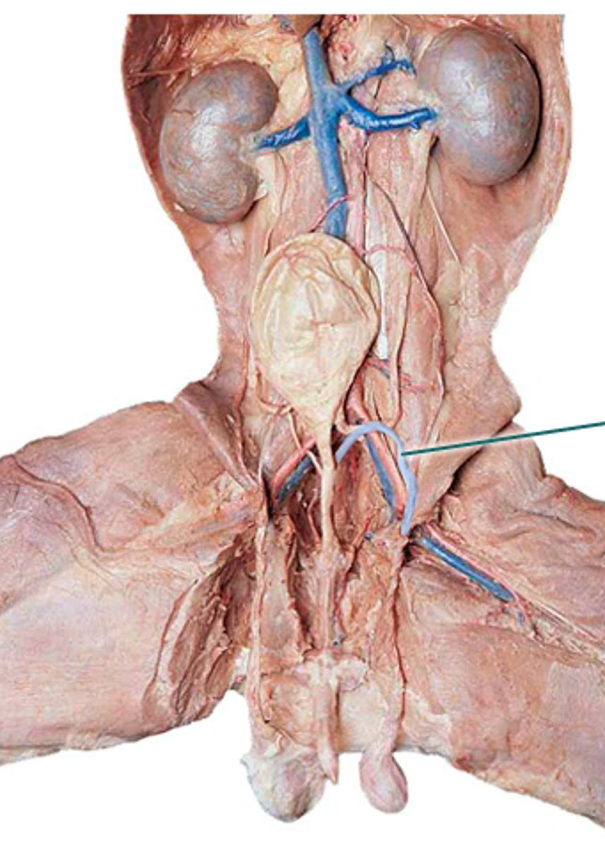<p>tube that carries sperm from the epididymis to the urethra</p>