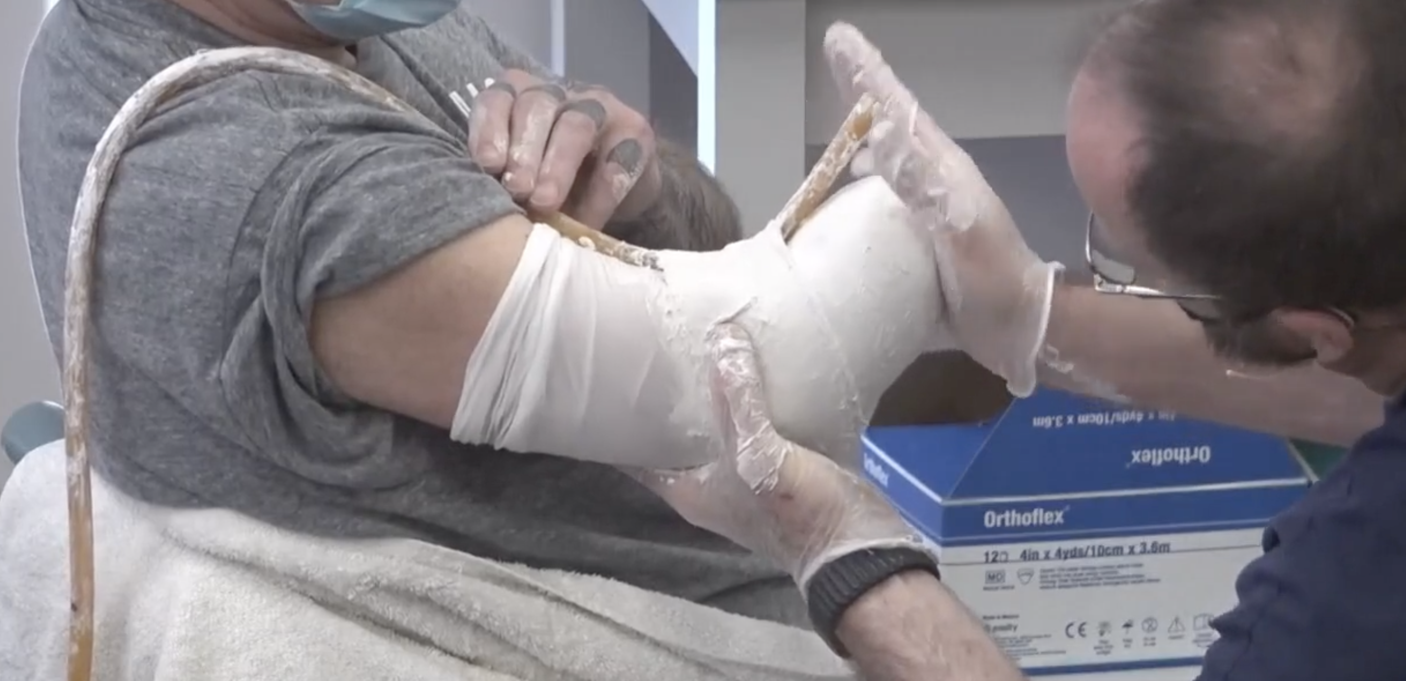 <p>above the epicondyles</p>