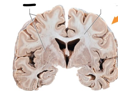 <p>Cell bodies, dendrites, interneurons</p><p>Generally forms the cortex</p><p>F: process information</p><p>Develops by 20s</p><p>No myelin </p>