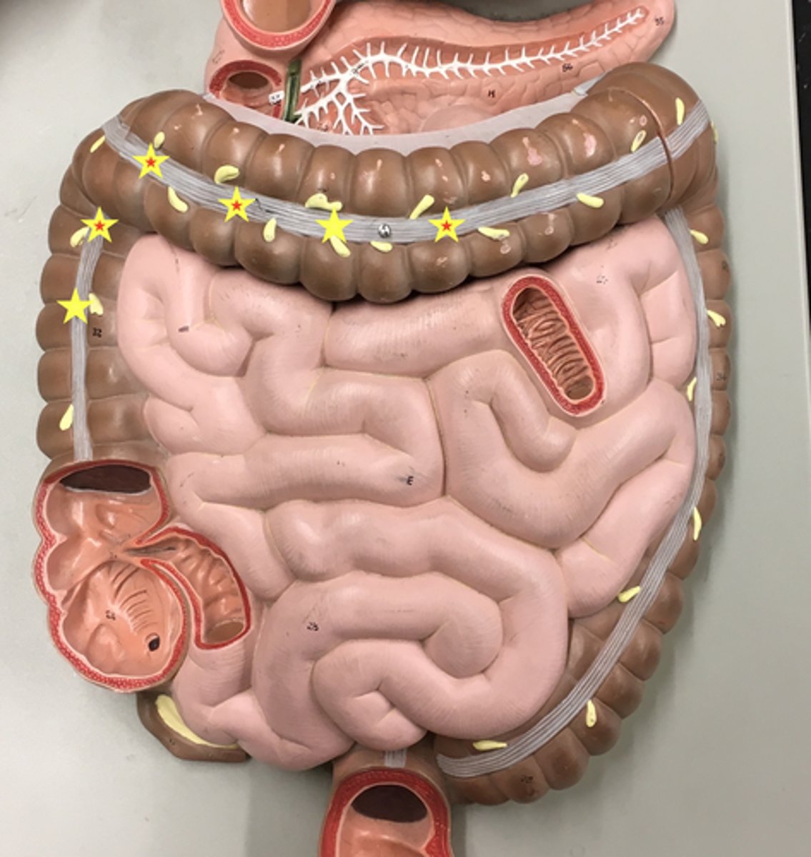 <p>Name this structure</p><p>- a tiny layer of muscle</p>