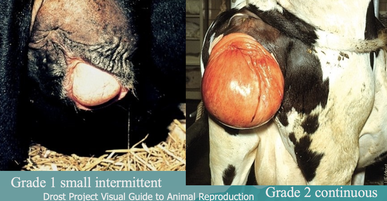 <p>grade 1: small intermittent</p><p>grade 2: continuous</p>