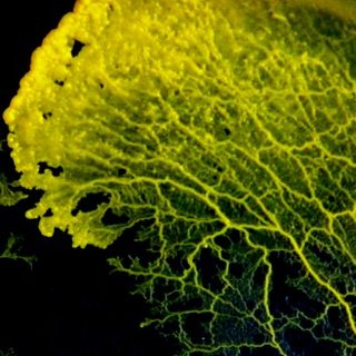 A ___________ ________ _________ is enclosed within a single membrane without walls and is one large cell. This "supercell" (a syncytium) is essentially a bag of cytoplasm containing thousands of individual nuclei.